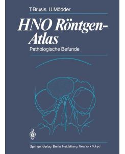 HNO Röntgen-Atlas Pathologische Befunde Gebundene Ausgabe von Tilman Brusis (Autor), Ulrich Mödder (Autor), G. Friedmann (Vorwort)