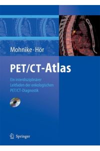 PET/CT-Atlas: Ein interdisziplinärer Leitfaden der onkologischen PET/CT-Diagnostik Wolfgang Mohnike and Gustav Hör