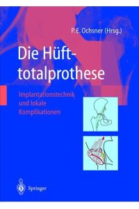 Die Hüfttotalprothese: Implantationstechnik und lokale Komplikationen Ochsner, Peter E.