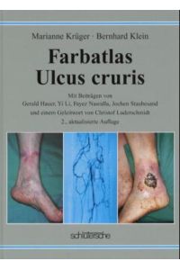 Farbatlas Ulcus cruris  - Mit Beiträgen von Jochen Staubesand und Yi Li, Gerald Hauer und Fayez Nasralla und einem Geleitwort von Christof Luderschmidt