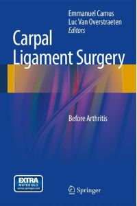 Carpal Ligament Surgery  - Before Arthritis