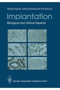 Implantation  - Biological and Clinical Aspects