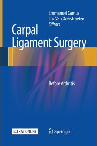 Carpal Ligament Surgery  - Before Arthritis