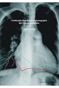 Funktionelle Magnetresonanztomographie des Truncus pulmonalis