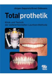 Totalprothetik: Klinik und Technik der weiterentwickelten Lauritzen-Methode