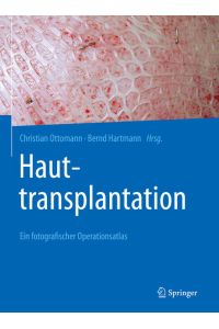 Hauttransplantation: Ein fotografischer Operationsatlas