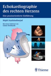 Echokardiographie des rechten Herzens: Eine praxisorientierende Einführung: Eine praxisorientierte Einführung