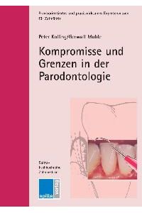 Kompromisse und Grenzen in der Parodontologie von Peter Kolling (Autor), Gerwalt Muhle