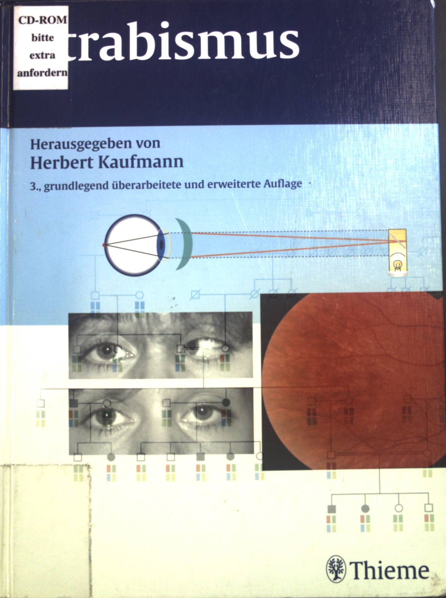 Strabismus : 72 Tabellen. - Kaufmann, Herbert und Wilfried de Decker