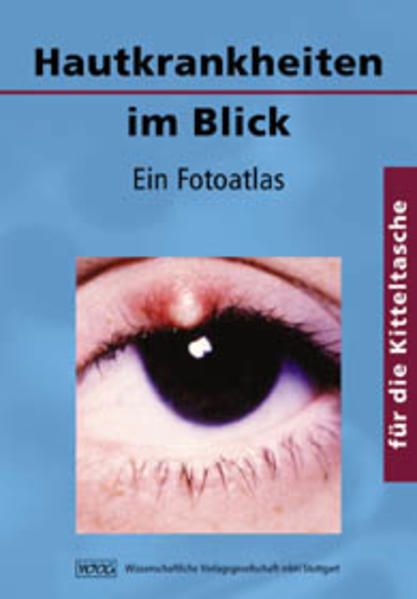 Hautkrankheiten im Blick: Ein Fotoatlas für die Kitteltasche - Niedner, Roland und Yael Adler