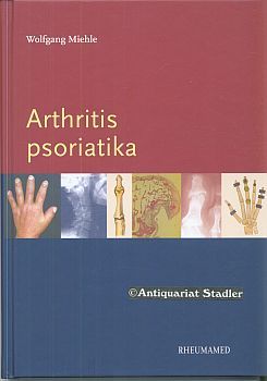 Arthritis psoriatica. - Miehle, Wolfgang