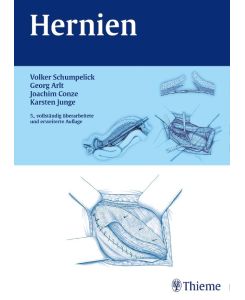 Hernien [Gebundene Ausgabe] von Volker Schumpelick, Georg Arlt, Klaus Joachim Conze, Karsten Junge (Autoren)