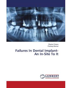 Failures In Dental Implant- An In-Site To It