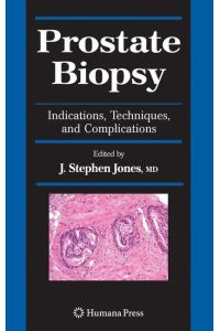 Prostate Biopsy  - Indications, Techniques, and Complications
