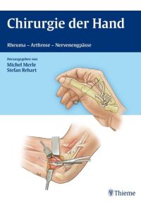 Chirurgie der Hand: Rheuma - Arthrose - Nervenengpässe [Hardcover] Merle, Michel and Rehart, Stefan