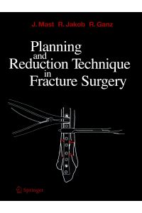 Planning and Reduction Technique in Fracture Surgery