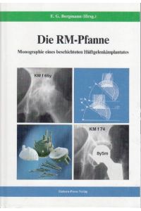 Die RM-Pfanne  - - Monographie eines beschichteten Hüftgelenkimplantates -