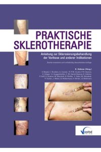 Praktische Sklerotherapie  - Anleitung zur Sklerosierungsbehandlung der Varikose und anderer Indikationen