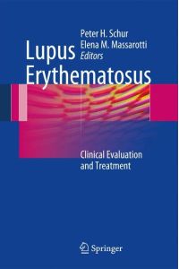 Lupus Erythematosus  - Clinical Evaluation and Treatment