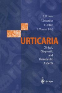 Urticaria  - Clinical, Diagnostic and Therapeutic Aspects