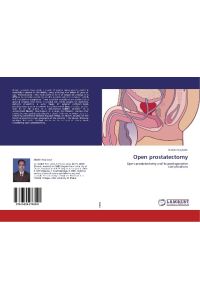 Open prostatectomy  - Open prostatectomy and its post operative complications