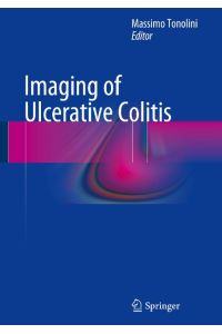 Imaging of Ulcerative Colitis