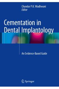 Cementation in Dental Implantology  - An Evidence-Based Guide