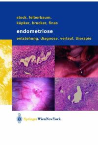 Endometriose  - Entstehung, Diagnose, Verlauf und Therapie
