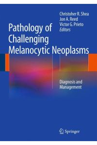 Pathology of Challenging Melanocytic Neoplasms  - Diagnosis and Management