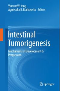 Intestinal Tumorigenesis  - Mechanisms of Development & Progression