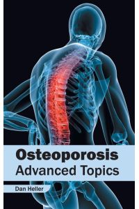 Osteoporosis - Advanced Topics