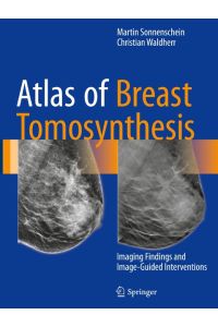 Atlas of Breast Tomosynthesis  - Imaging Findings and Image-Guided Interventions