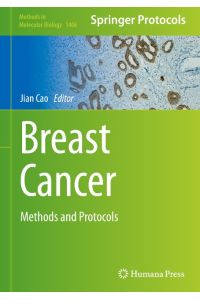 Breast Cancer  - Methods and Protocols