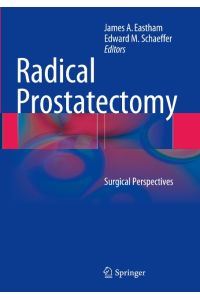Radical Prostatectomy  - Surgical Perspectives