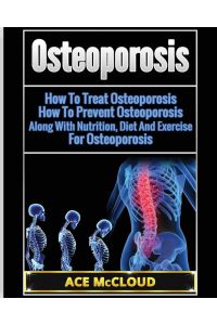 Osteoporosis - How To Treat Osteoporosis: How To Prevent Osteoporosis: Along With Nutrition, Diet And Exercise For Osteoporosis