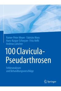 100 Clavicula-Pseudarthrosen  - Fehleranalysen und Behandlungsvorschläge