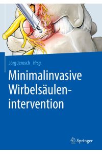 Minimalinvasive Wirbelsäulenintervention