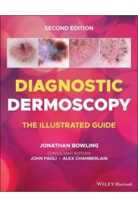 Diagnostic Dermoscopy  - The Illustrated Guide