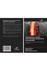 Osteotomie a ponte nell'artrodesi posteriore strumentata  - Trattamento chirurgico della cifosi nella malattia di Scheuermann