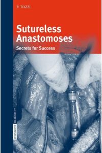 Sutureless Anastomoses  - Secrets for Success