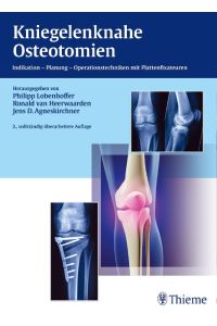 Kniegelenknahe Osteotomien  - Indikation - Planung - Operationstechniken mit Plattenfixateuren