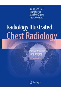Radiology Illustrated: Chest Radiology  - Pattern Approach for Lung Imaging