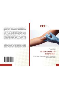 Le test cutané à la tuberculine - Performance diagnostique pour la détection de la tuberculose active