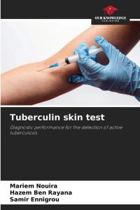 Tuberculin skin test - Diagnostic performance for the detection of active tuberculosis
