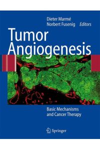Tumor Angiogenesis  - Basic Mechanisms and Cancer Therapy