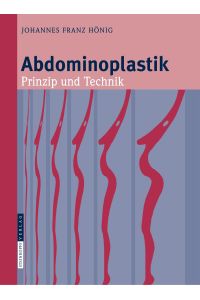 Abdominoplastik  - Prinzip und Technik