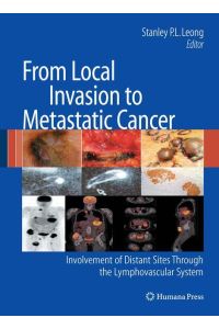 From Local Invasion to Metastatic Cancer  - Involvement of Distant Sites Through the Lymphovascular System
