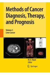 Methods of Cancer Diagnosis, Therapy, and Prognosis  - Liver Cancer
