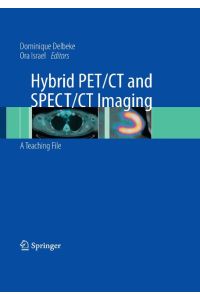Hybrid PET/CT and SPECT/CT Imaging  - A Teaching File