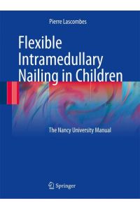Flexible Intramedullary Nailing in Children  - The Nancy University Manual